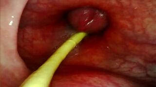 ANAL POV. CAMERA INSIDE HER ASSHOLE AS I POUND HER WITH MY BIG COCK AND CUM DEEP INSIDE